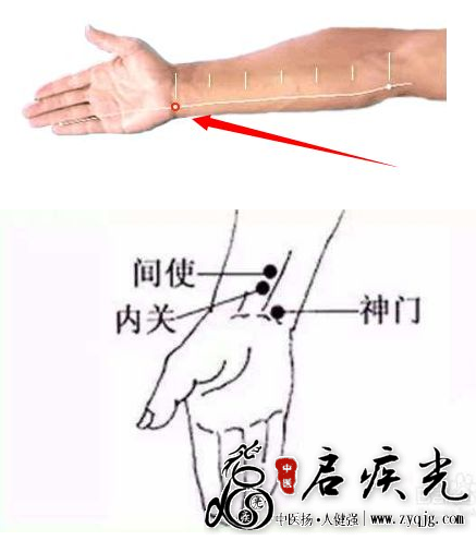 神门穴位置图  