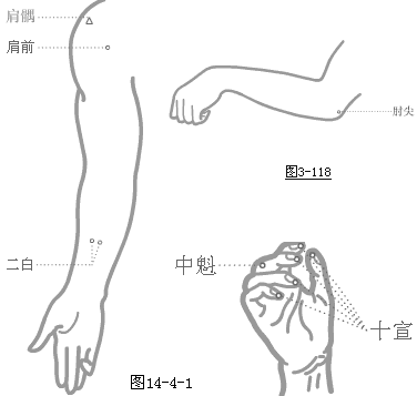 奇穴上肢穴