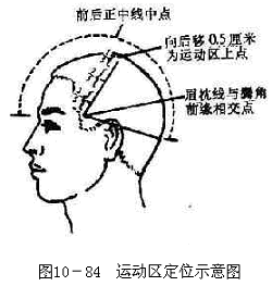 运动区定位示意图