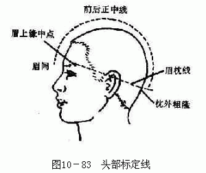 头针疗法