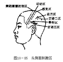 头侧面刺激区