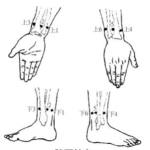 腕踝针疗法及其分区与主治病症