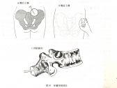 常用急救诊疗技术●穿刺术●骨髓穿刺术