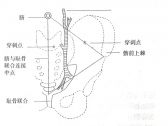 常用急救诊疗技术●穿刺术●腹腔穿刺术