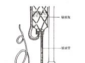 常用急救诊疗技术●穿刺术●中心静脉压测定术