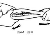 骨伤病的治疗方法·手法·正骨手法