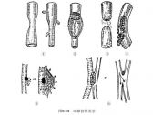 创伤急救·周围血管损伤