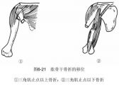 骨折·上肢骨折·肱骨干骨折