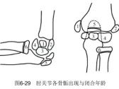 骨折·上肢骨折·肱骨外髁骨折