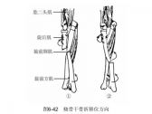 骨折·上肢骨折·尺桡骨干单骨折