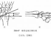 骨折·上肢骨折·桡骨远端骨折