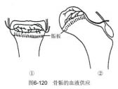 骨折·躯干骨折·骨骺损伤