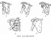 脱位·上肢脱位·肩关节脱位