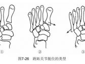 脱位·下肢脱位·跗跖关节脱位