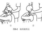 筋伤·颈部筋伤·落枕