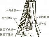 脊柱病证推拿●脊柱病证●前斜角肌综合征