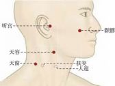 手太阳腧穴●天窗(别名：窗笼穴，窗聋穴，窗簧穴，天笼穴)