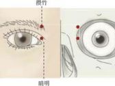 足太阳腧穴●攒竹(别名:眉头、眉本、员在、始光)