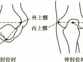 四肢关节病证推拿●四肢关节病证●肱骨外上髁炎