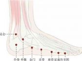 足太阳腧穴●仆参(别名:安邪穴;足太阳膀胱经、阳跷脉的交会穴) ...