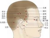 足少阳腧穴●颔厌(手少阳三焦经、足少阳胆经、足阳明胃经交会穴) ...