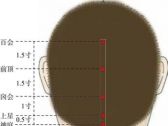 督脉腧穴●囟会(别名:囟门、顶门、天窗)